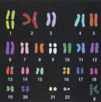 A colored human karyotype, which is a way of depicting a collection of chromosomes in an organism.